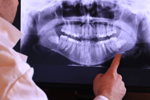 Best Same-Day Emergency Dental Services in James City, NC