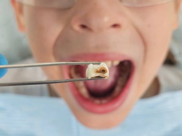 Best Same-Day Emergency Dental Services in James City, NC