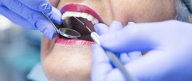 Best Emergency Dental Care for Broken or Chipped Teeth in James City, NC